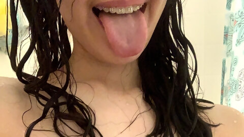 Braces